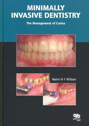  - Minimally Invasive Dentistry. The Management of Caries