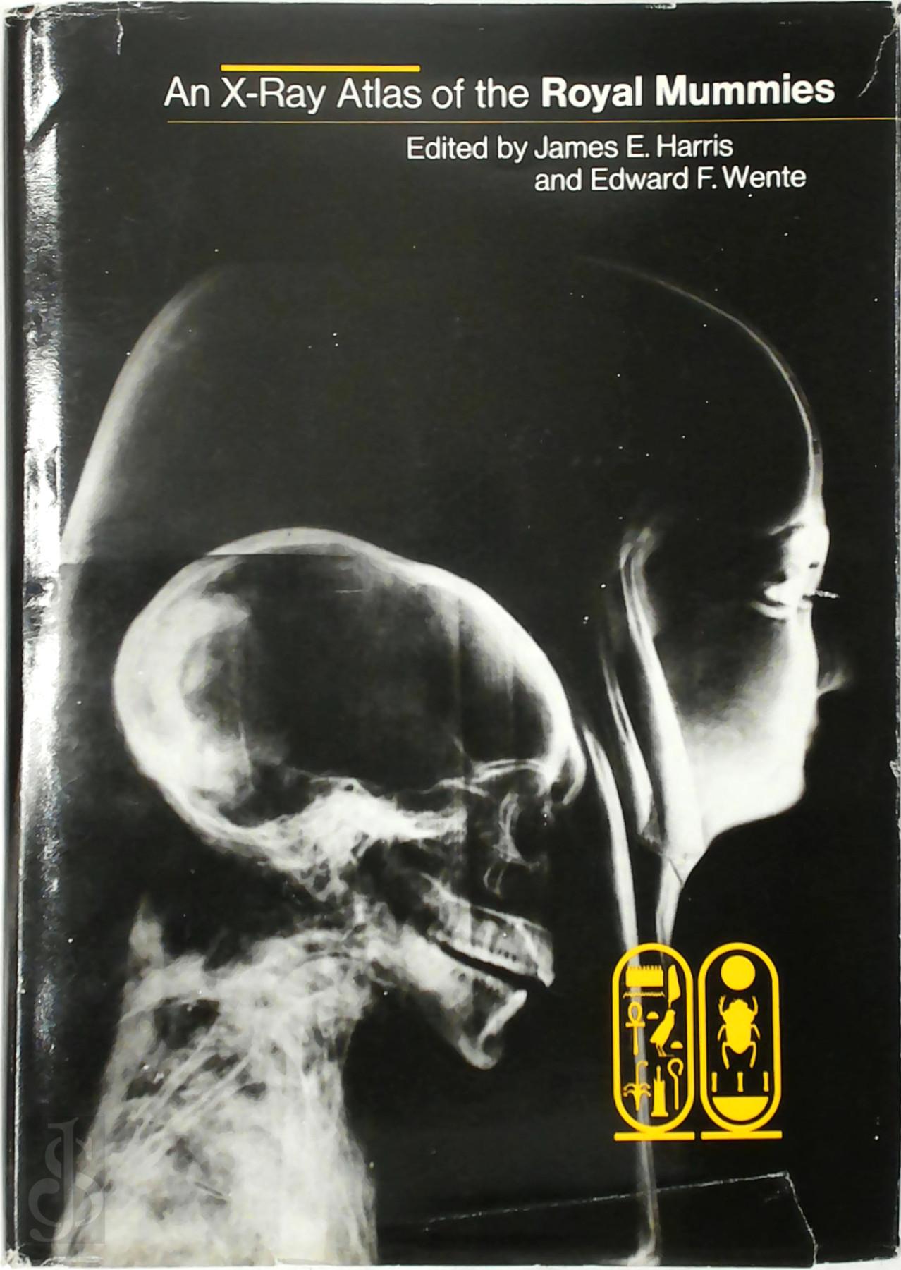 James E. Harris , Edward Frank Wente 266514 - An X-Ray Atlas of the Royal Mummies