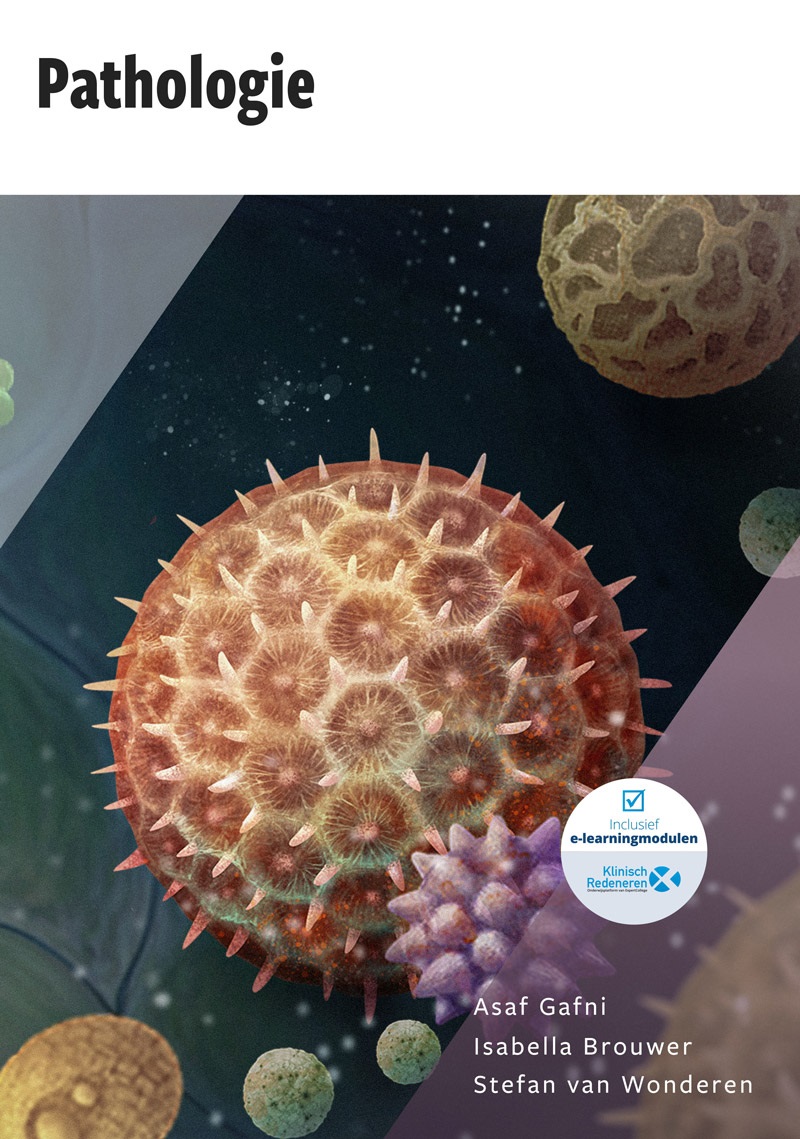 Asaf Gafni 153390, Isabella Brouwer 254548, Stefan van Wonderen 242683 - Pathologie