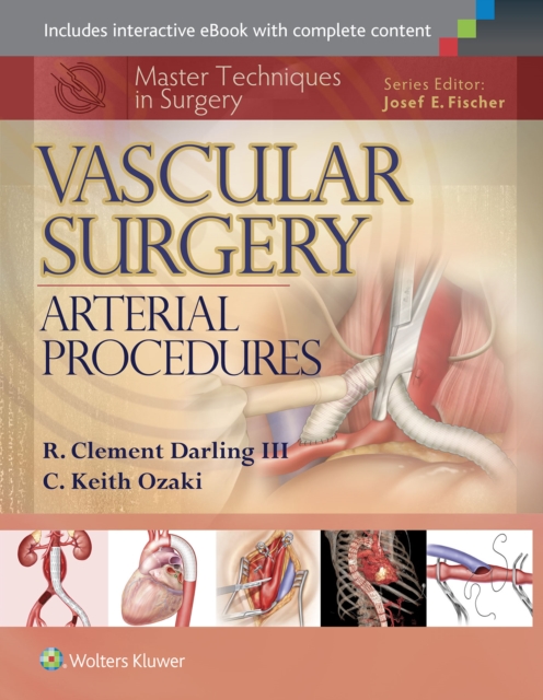 R. Clement Darling , C. Keith Ozaki - Master Techniques in Surgery: Vascular Surgery: Arterial Procedures