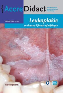 Leukoplakie en daarop lijkende afwijkingen - Isaäc van der Waal (ISBN 9789089762061)