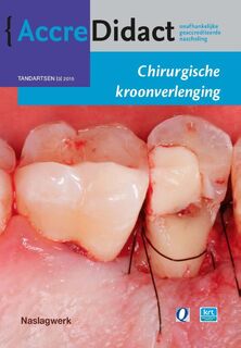Chirurgische kroonverlenging - S. Paraskevas (ISBN 9789089761958)