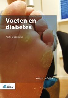 Voeten en diabetes - Margreet van Putten (ISBN 9789036802789)