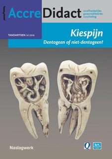 Kiespijn, dentogeen of niet-dentogeen? - Jan Warnsinck (ISBN 9789089762276)