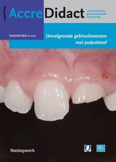 Onvolgroeide gebitselementen met pulpaletsel - Marga Ree (ISBN 9789089762108)