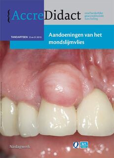 Aandoeningen van het mondslijmvlies - Isaac van der Waal (ISBN 9789089761224)