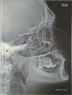 Ice - Antoine D' Agata (ISBN 9782849952054)