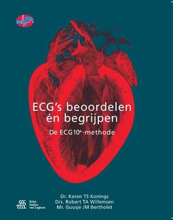 ECG's - beoordelen én begrijpen - Karen Konings, Robert Willemsen, Guusje Bertholet (ISBN 9789036817288)