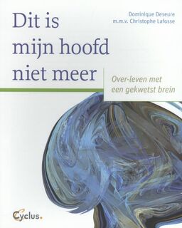 Dit is mijn hoofd niet meer - Dominique Deseure, Christophe Lafosse (ISBN 9789085750468)
