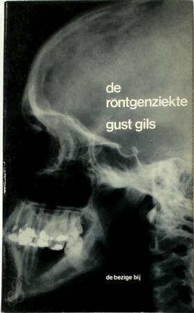 De röntgenziekte - Gust Gils De röntgenziekte - Gust Gils