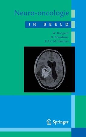 Neuro-oncologie in beeld - W. Boogerd, E.A.C.M. Sanders, D. Brandsma