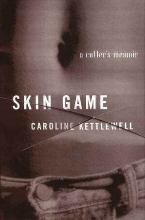 Skin Game - Caroline Kettlewell
