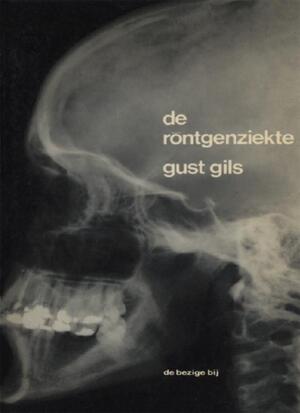 De röntgenziekte - Gust Gils De röntgenziekte - Gust Gils