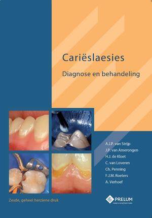 Carieslaesies - A.J.P. van Strijp, J.P. van Amerongen, H.J. de Kloet, C. van Loveren Carieslaesies - A.J.P. van Strijp, J.P. van Amerongen, H.J. de Kloet, C. van Loveren
