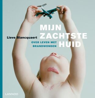 Mijn zachtste huid / - Lieve Blancquaert (ISBN 9789020986143)