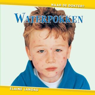 Waterpokken - Elaine Landau